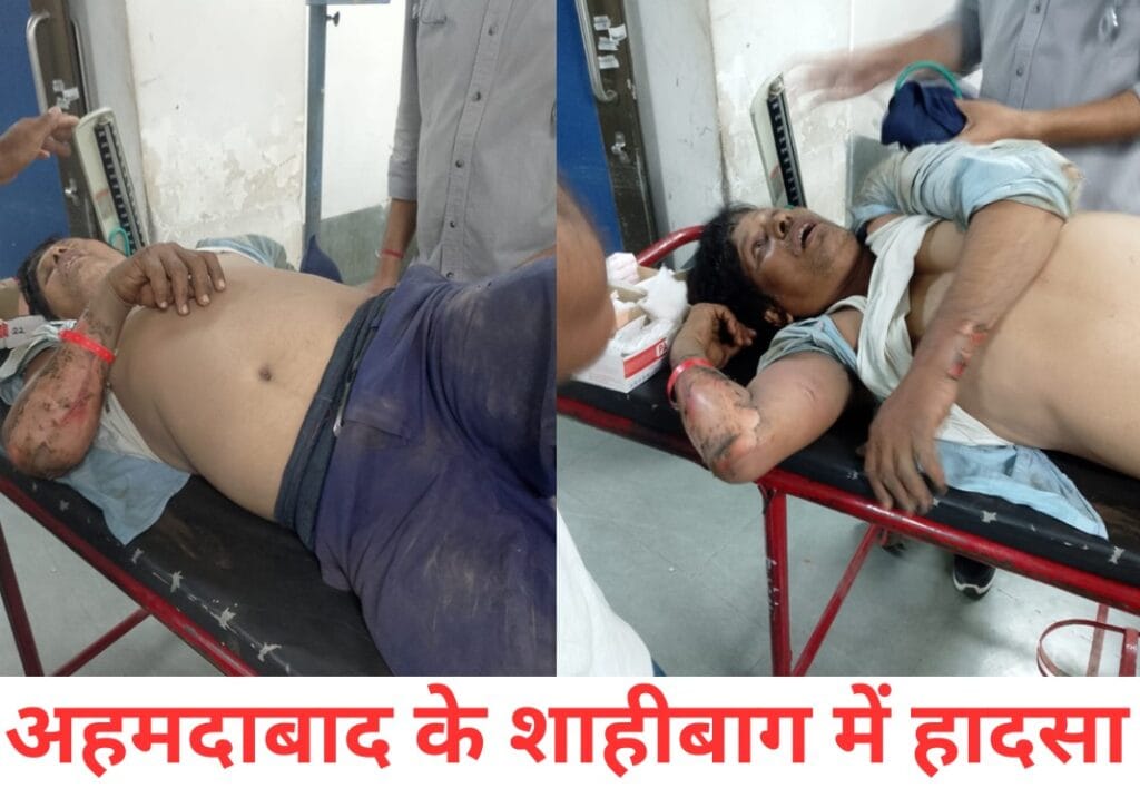 OHE block लिये बिना ही शिफ्ट करवा रहे थे सिग्नल S-12, दो कर्मचारी झुलसकर गंभीर
